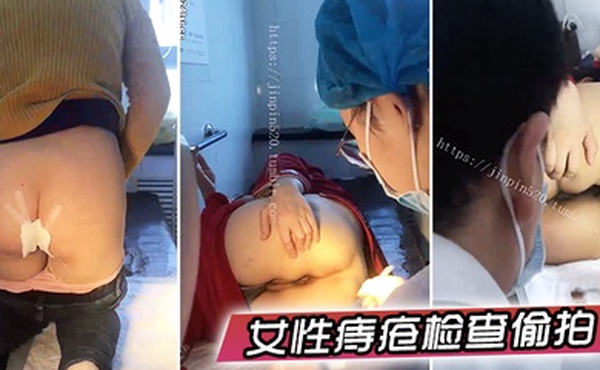 女性痔疮检查偷拍国内某小诊所女性痔疮检查治疗多位大屁股女性被偸拍大夫居然是男的一指使劲往菊花里捅紧张的腿直抖紧紧抓着护栏_