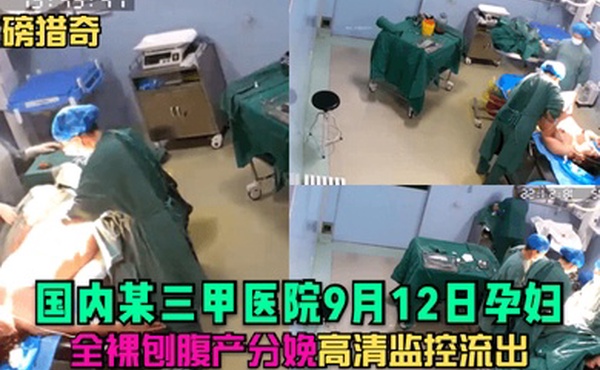 重磅猎奇国内某三甲医院9月12日孕妇全裸刨腹产分娩高清监控流出