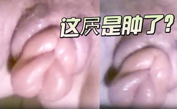 这屄是被玩肿了